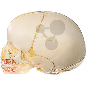 Crâne de nouveau-né Somso