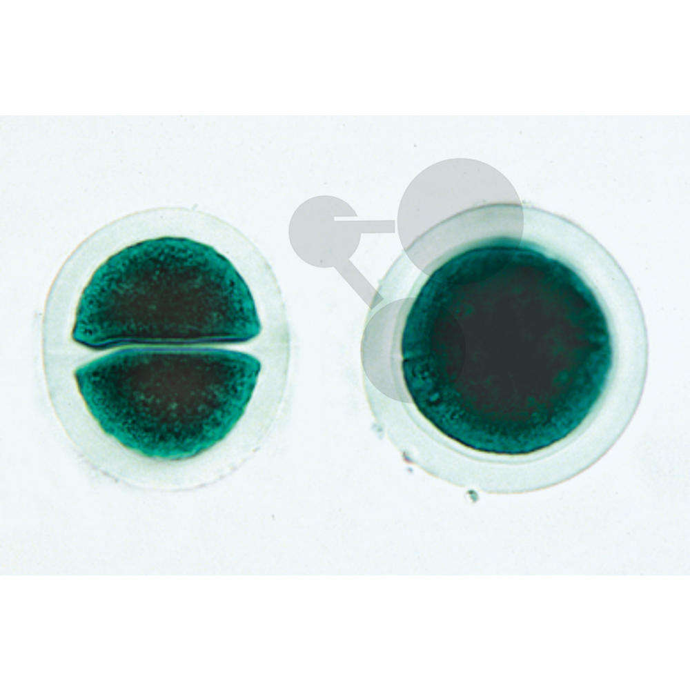 Prép. Micro. Chroococcus, algue bleue unicellulaire