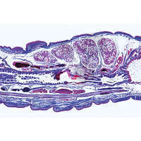 Prép. Micro. Lombrics, extrémité antérieure avec organes génitaux